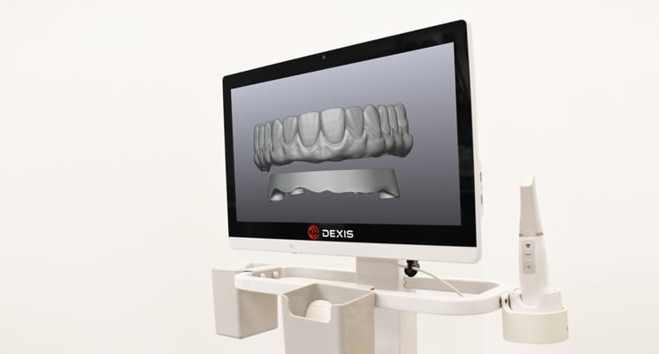 Dentisterie numérique scanner