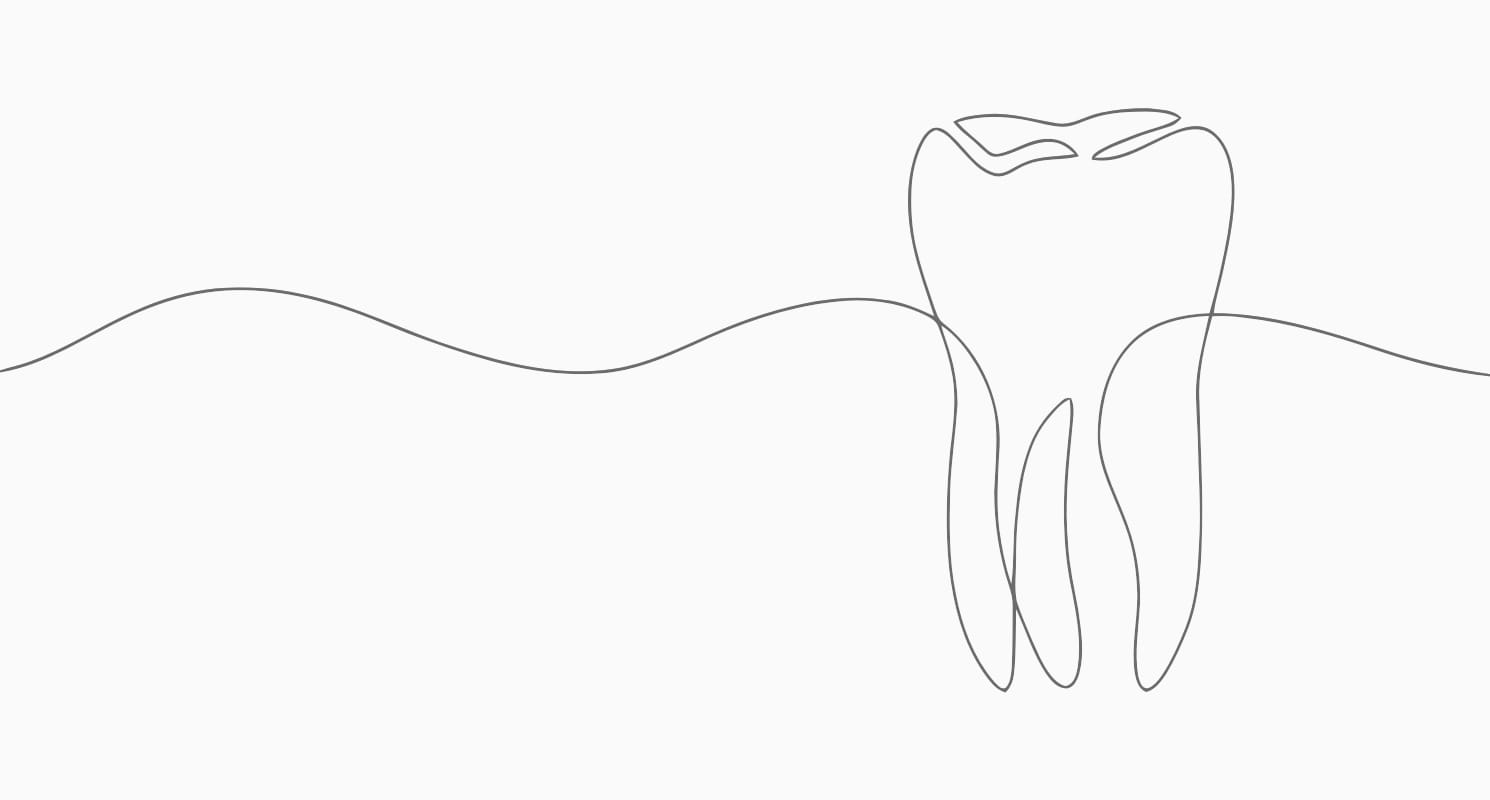 Parodontologie illustration