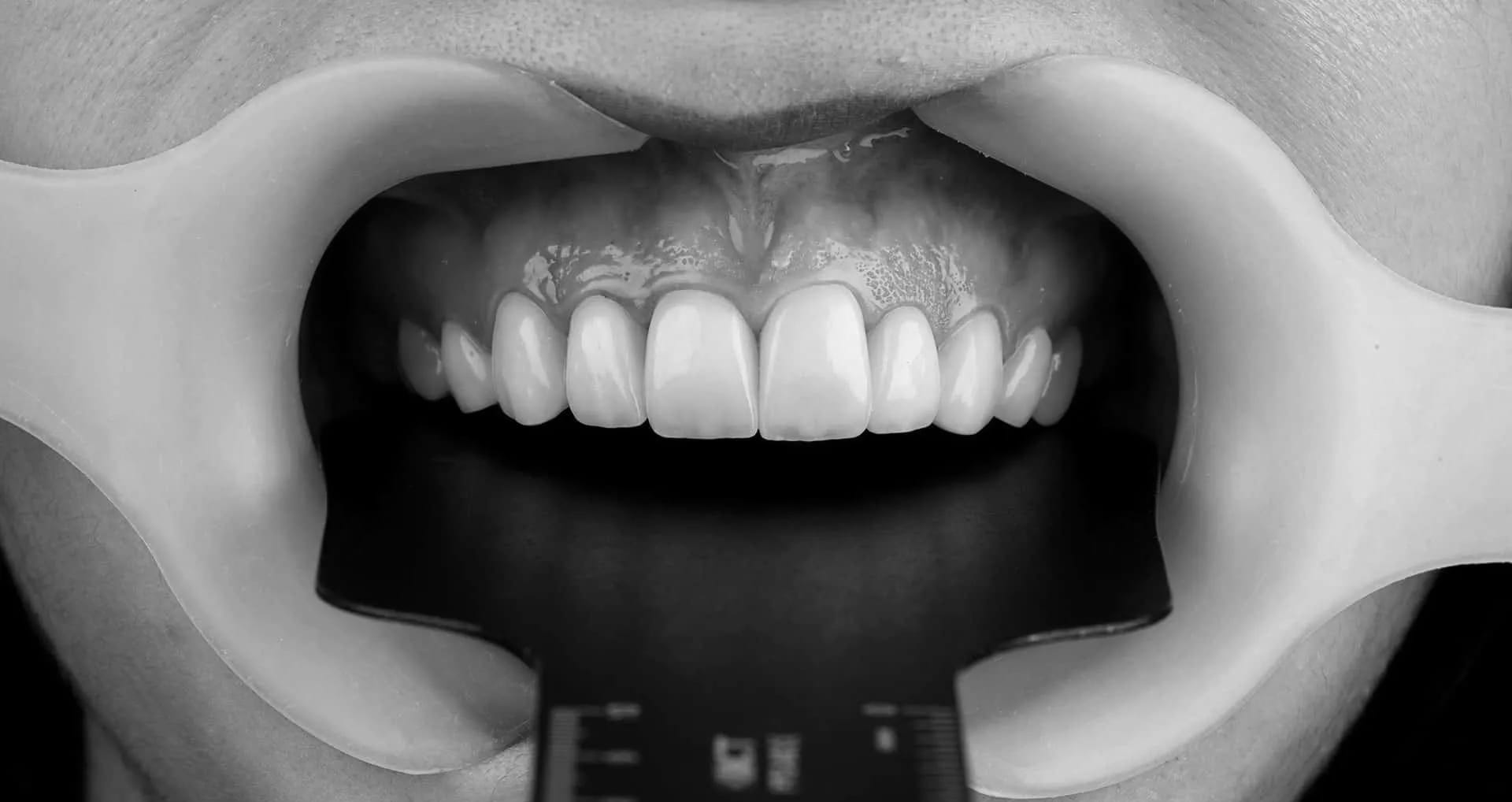 Dentisterie esthétique Paris